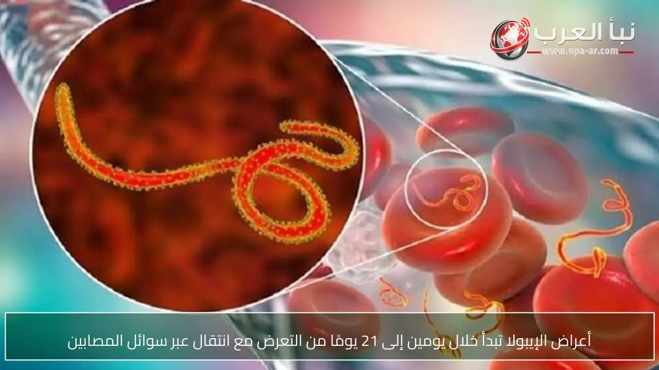 أعراض الإيبولا تبدأ خلال يومين إلى 21 يومًا من التعرض مع انتقال عبر سوائل المصابين