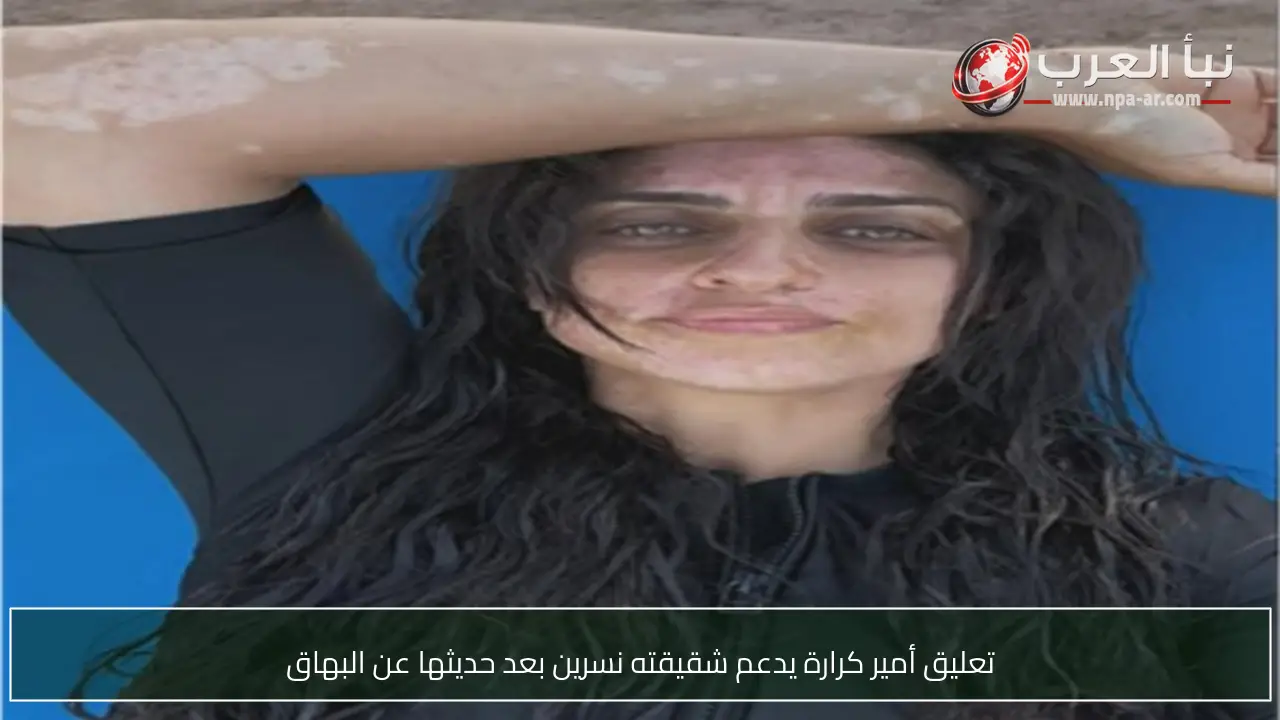 تعليق أمير كرارة يدعم شقيقته نسرين بعد حديثها عن البهاق