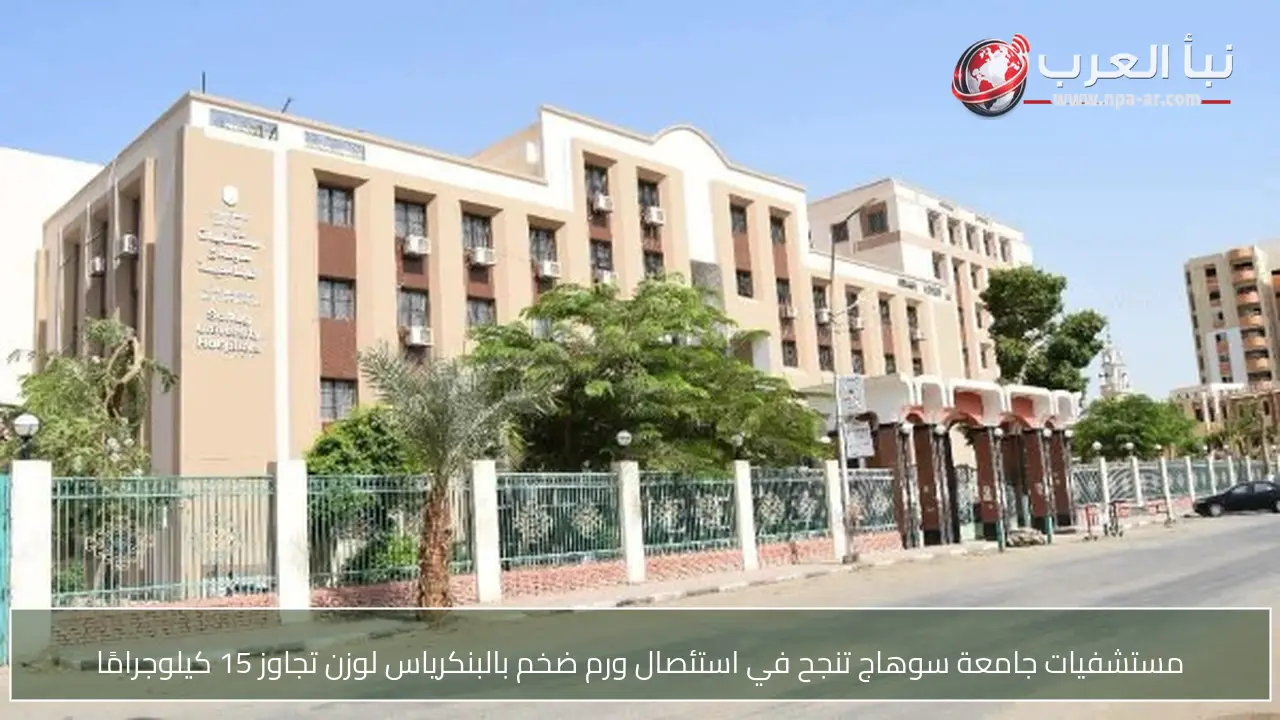 مستشفيات جامعة سوهاج تنجح في استئصال ورم ضخم بالبنكرياس لوزن تجاوز 15 كيلوجرامًا
